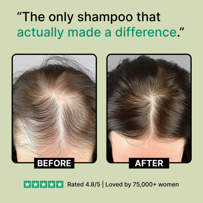 Revive Your Roots and Restore Your Confidence with Nuvara