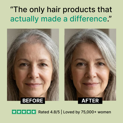 Nuvara Root Revival Hair Growth Serum™