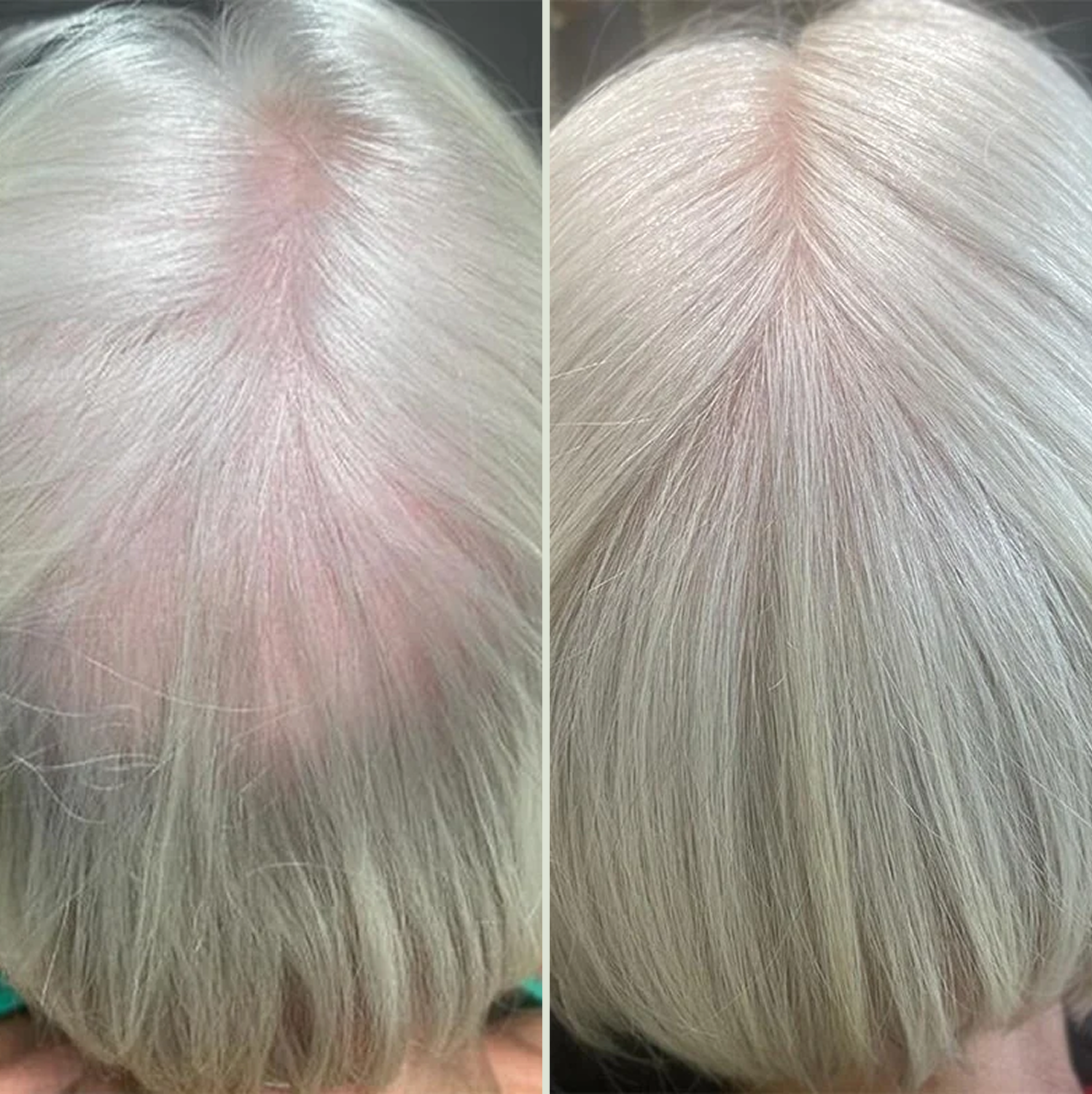 Nuvara Root Revival Complete Kit