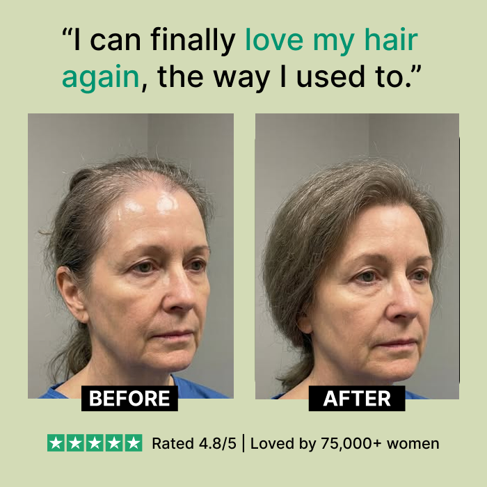 Nuvara Root Revival Hair Growth Serum™