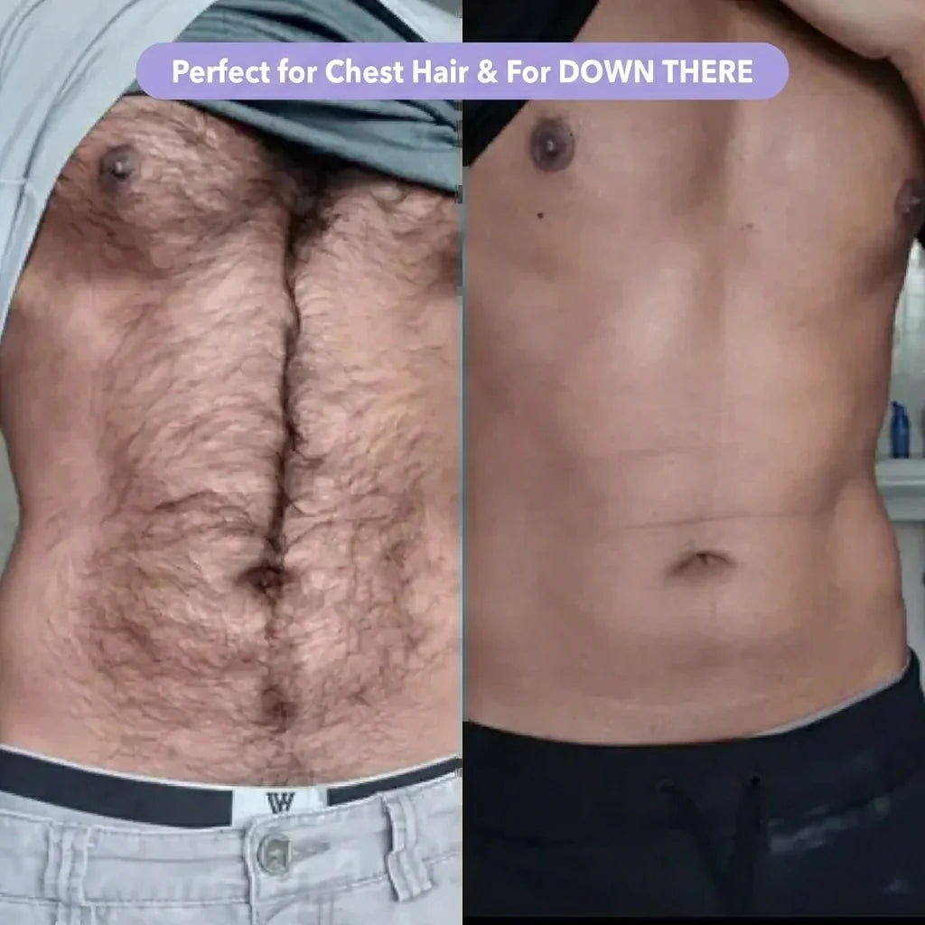 Cloud Sense — Razor-Free, Pain-Free Hair Removal In 10 Minutes