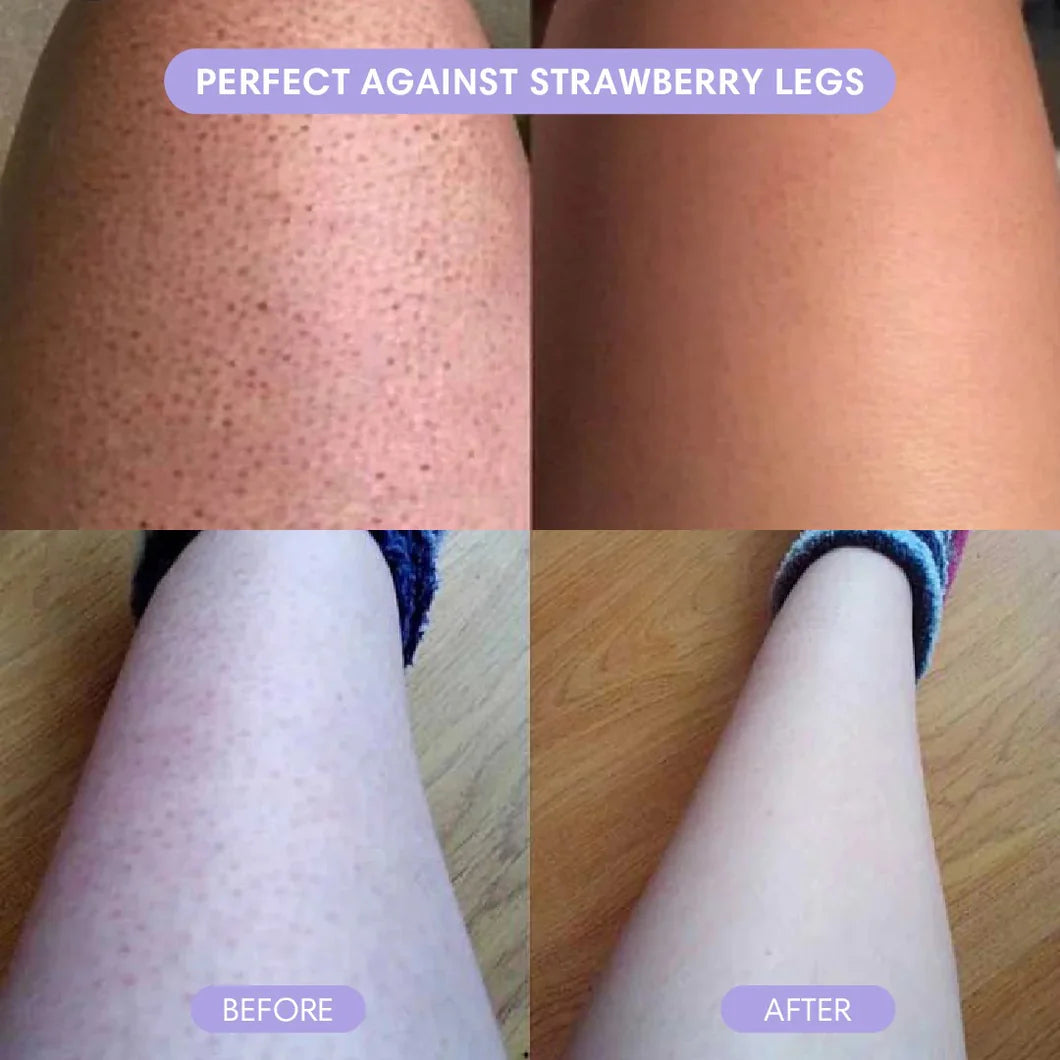 Cloud Sense — Razor-Free, Pain-Free Hair Removal In 10 Minutes